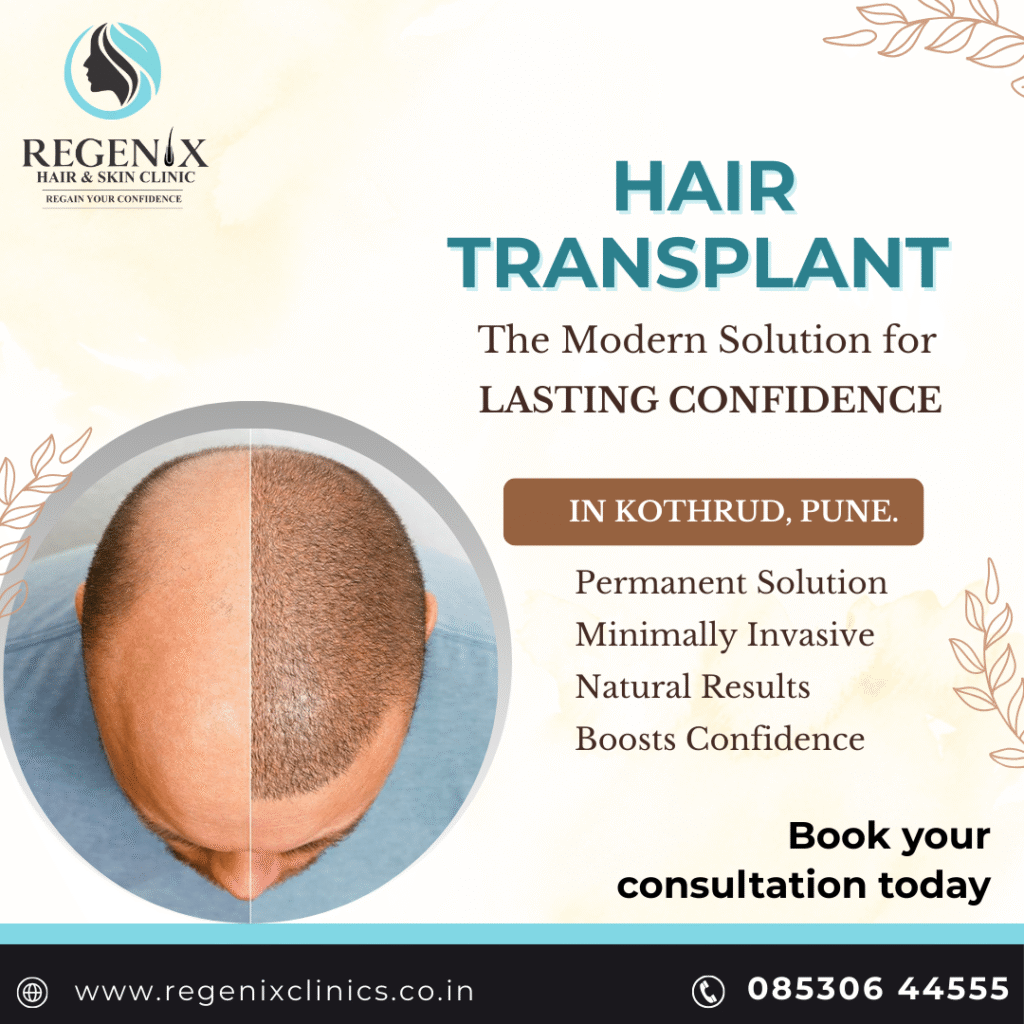Hair Transplant Kothrud