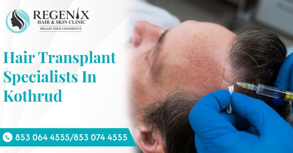 Hair Transplant Kothrud
